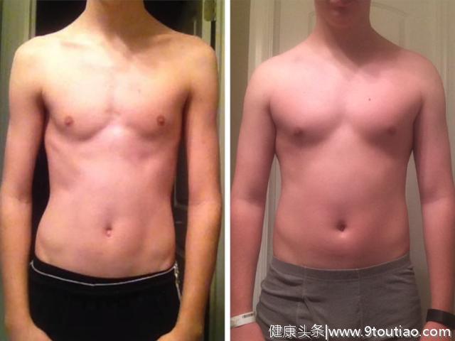 83斤小伙瘦到极致，坚持健身1年看效果，直言增肌狂吃就妥了！