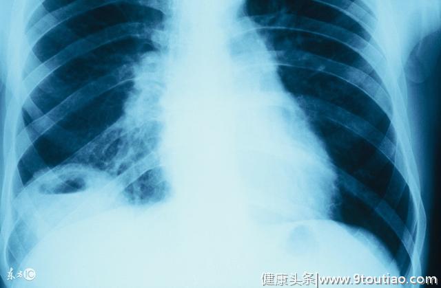 呼吸系统感染患者有哪些症状特点