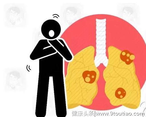 肺癌说来就来？若异常咳嗽外，还伴随这3种“异常”，赶紧去检查