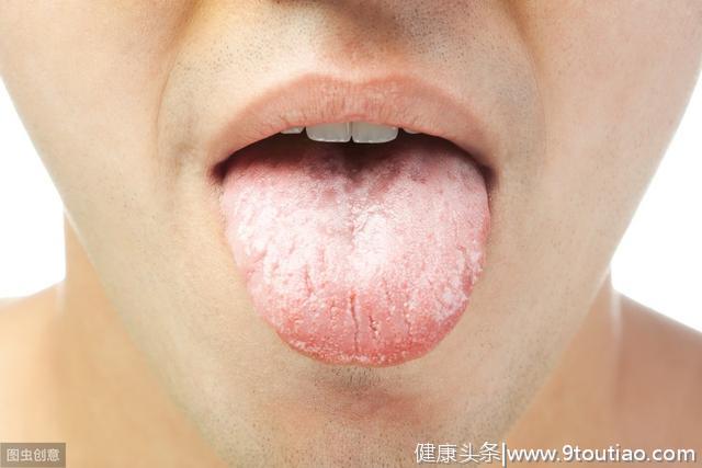 口腔内壁上长了白色条纹？医生提醒：小心是口腔癌的前兆！