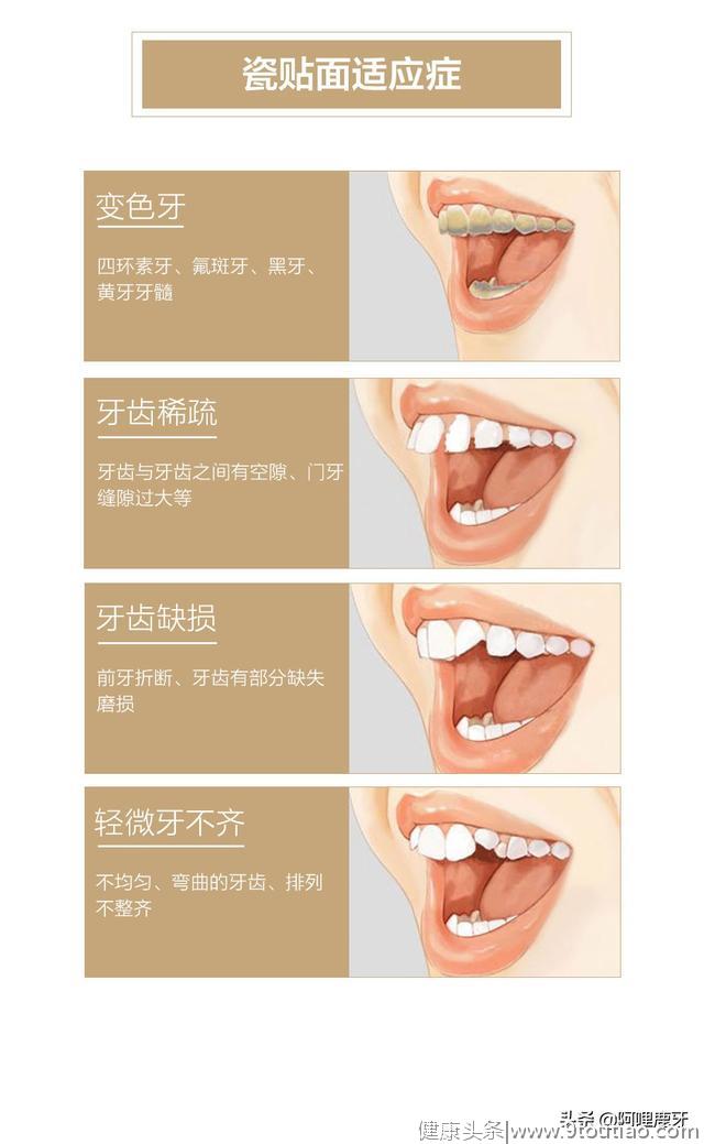 牙齿，口腔里的艺术品