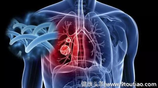 四种职业患肺癌风险高，做好2点措施，降低得肺癌的几率！