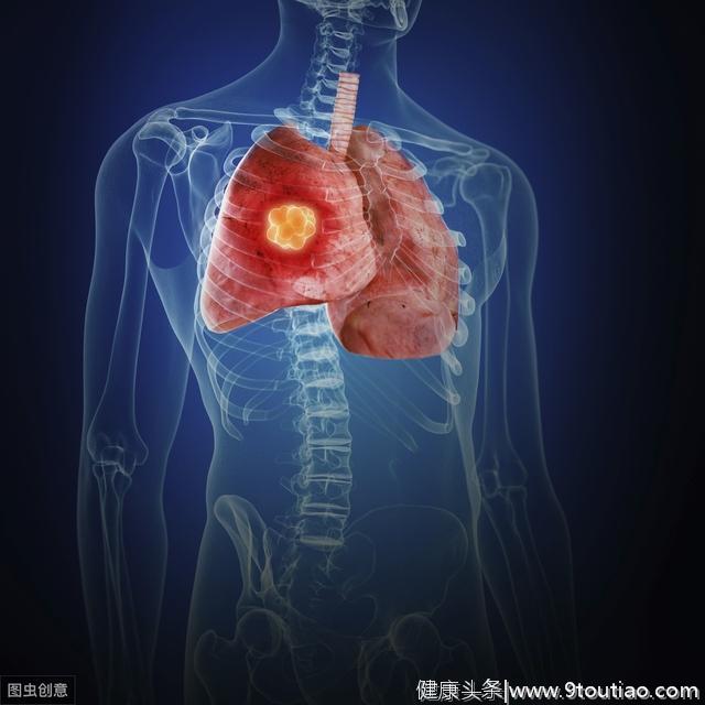 肺癌来袭，身体一旦出现“1大2痛”，十有八九是肺癌，快查肺CT