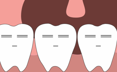 牙齿是怎样被“虫子吃掉”的？原来每一步都是蓄谋已久