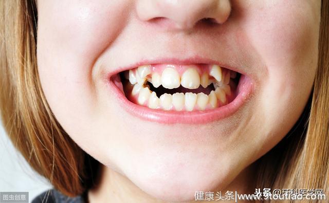 儿童预防牙齿不整齐的方法