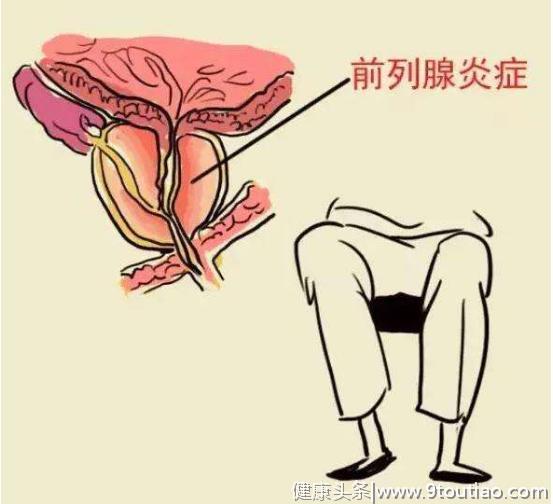 50岁以上北京男性中，40%患有前列腺增生！