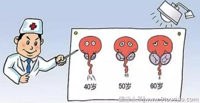 50岁以上北京男性中，40%患有前列腺增生！