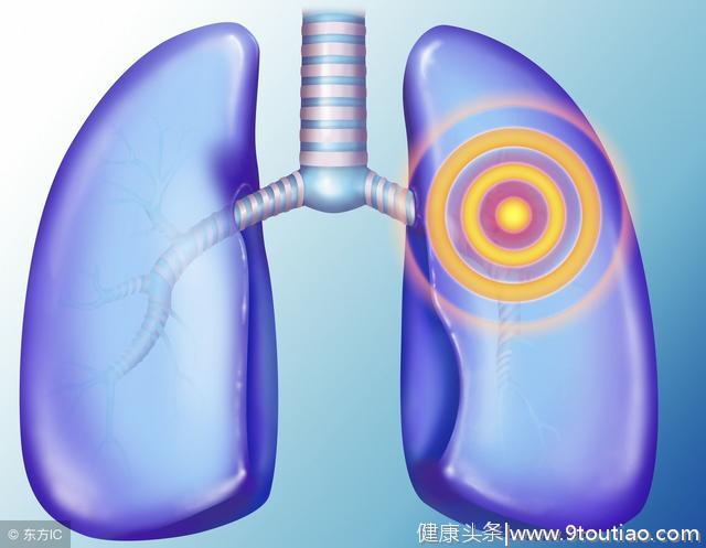 反复肺炎的临床表现是什么