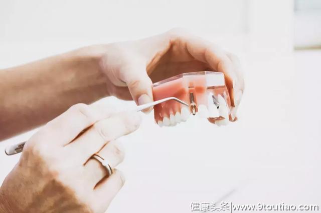 牙齿有黑点、塞牙、缺牙…是小事？牙医表示：不加重视，后果严重