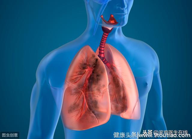 你为什么会患上肺癌？这几个因素，要避开！