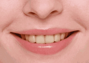 牙齿美白才是你颜值爆表的捷径！一秒入夏，露美的季节到了~