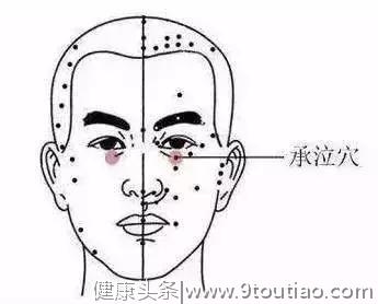 去眼袋秘方——五个穴位