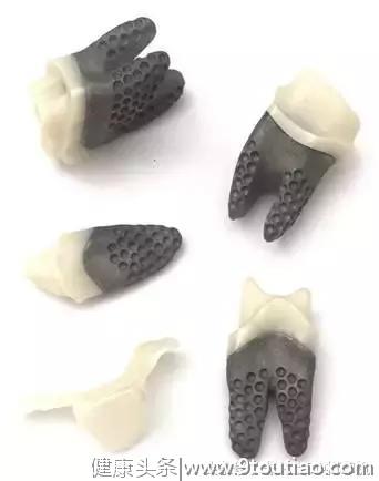 3D打印技术在齿科行业的应用