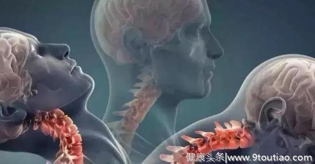 颈椎病不止影响颈椎，身体的这些部位也会跟着受到影响