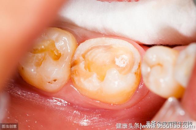 5种情况会导致牙齿松动，不及时治疗，小心牙齿脱落