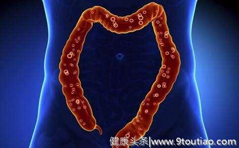 北京人肠癌发病率上升迅速，有3种生活习惯的人，最好去医院检查
