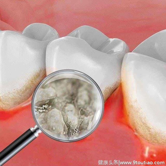 定期看牙还能预防肺炎？