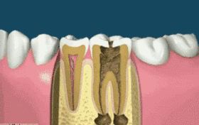 牙齿松动怎么办？这几种方法你要知道