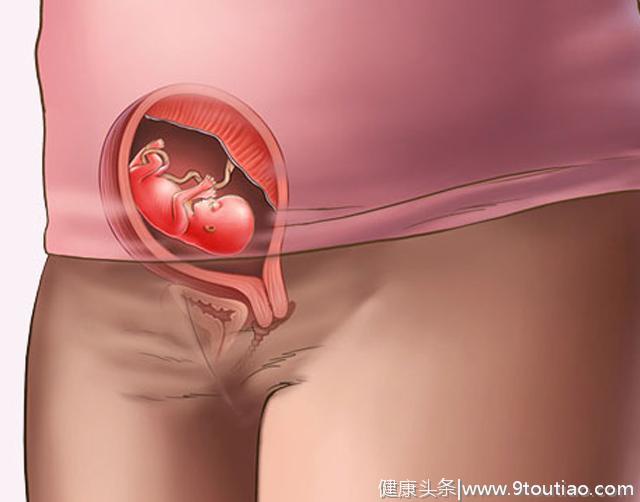 怀孕3个半月孕妇流产，只因B超发现是女孩，胎儿的样子你可曾知道
