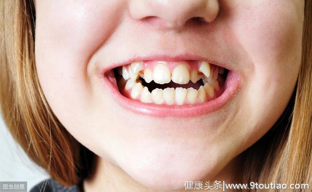 儿童牙齿不整齐有多大危害，你知道吗？