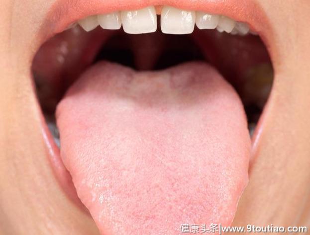 最全舌诊图解！中医教你6大方法，看舌头懂健康，收藏备用