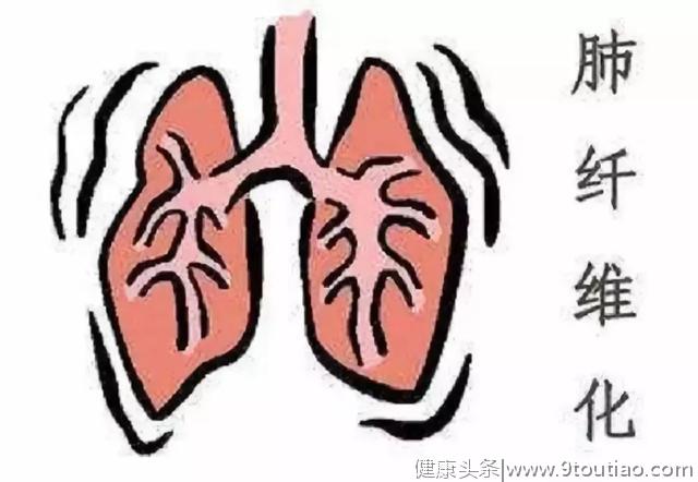 中医治疗肺纤维化有优势
