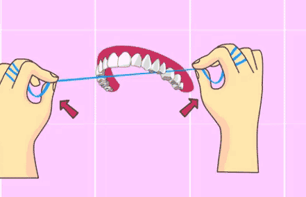 “矫正过牙齿的人会比其他人更容易长蛀牙”，是真的吗？