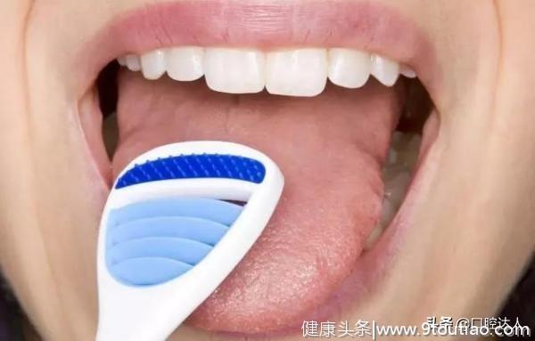 恒伦口腔科普：洗舌头应该与刷牙一样，成为每天的例行公事