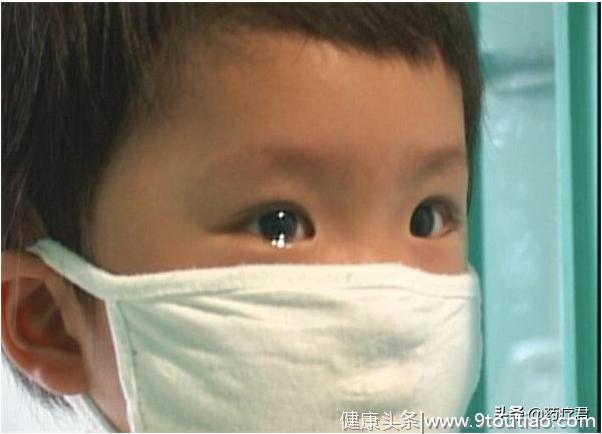 患白血病的孩子越来越多？医生告诫，小孩子要远离这些污染源