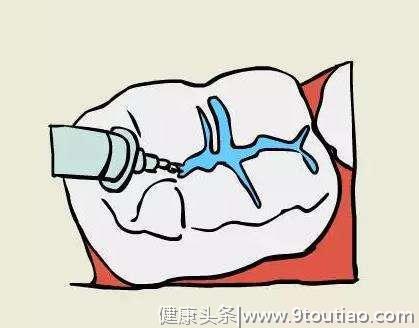 儿童齿科专家刘青青：儿牙治疗进入精准舒适诊疗新时代