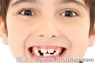 孩子只有12岁才是矫正牙齿的时机？不，前面还有2个黄金期