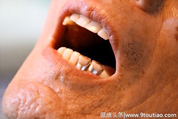 为什么牙齿上有一层“黄泥”，味道还很臭？可能是几件事没有做好