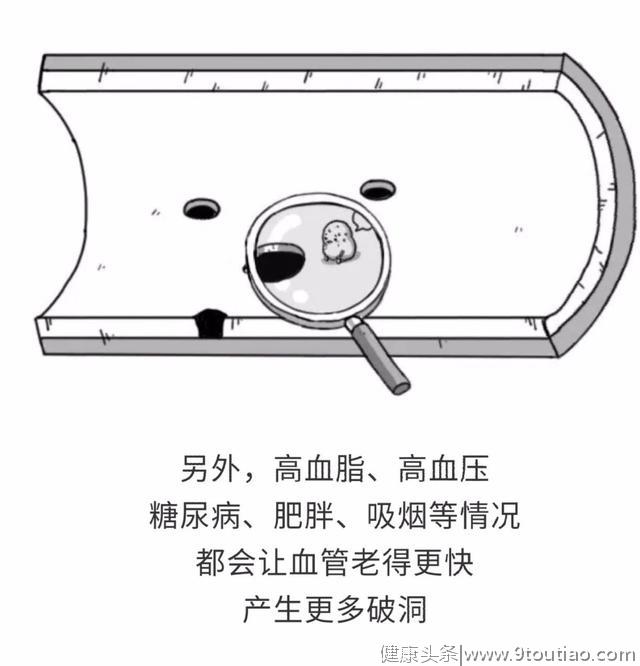 「民间偏方奇效方」高脂血症