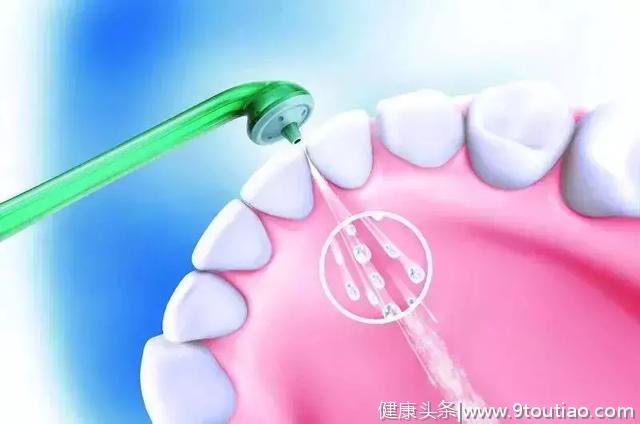 什么是洗牙？什么是牙周刮治？两者到底有什么区别？