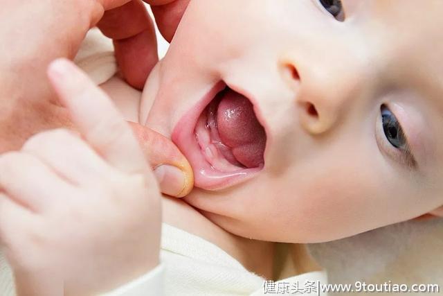 口腔健康知识——婴幼儿篇