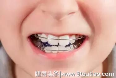 这5个口腔误区，80％的家长都有！难怪孩子牙齿出现问题