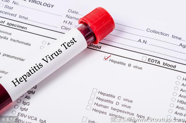慢性丙型肝炎要怎么诊断和检查？很简单，2个方法可检测