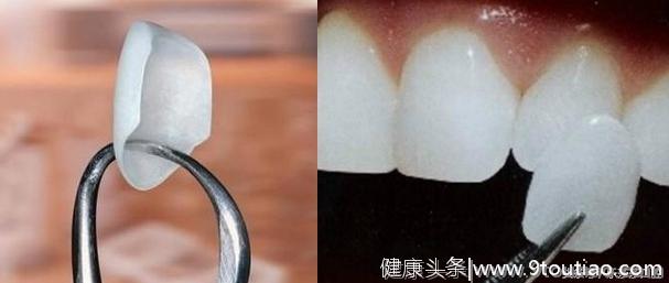 史上最全牙齿美白方法，没有之一！