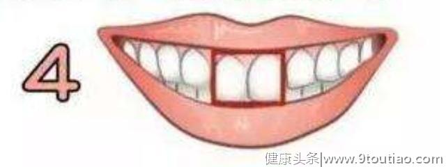 你的牙齿是哪一种形状？测你有没有天生的富贵命