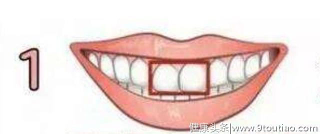 你的牙齿是哪一种形状？测你有没有天生的富贵命