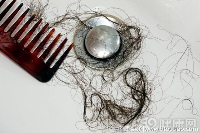 90后脱发，80后秃顶，中国男人还剩多少头发？