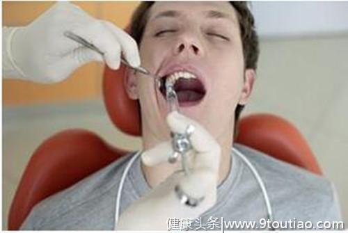 大连齿医生口腔科普 五种牙齿非拔不可 拔牙后患者该怎么办