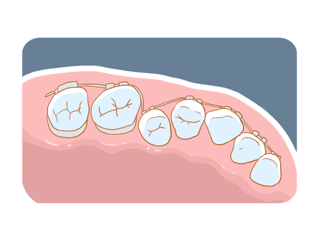 牙齿不齐首先危害的不是面容！而是你的牙周健康