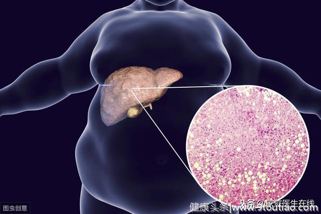 脂肪肝是身体的“定时炸弹”，教你3招来消除危险