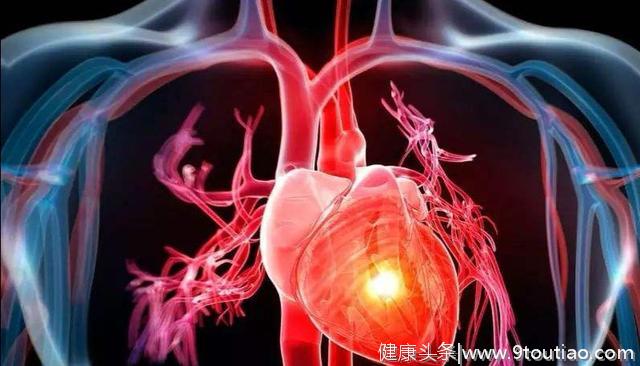 心脏病发作前有哪些前兆和信号？心脏病专家告诉您答案！