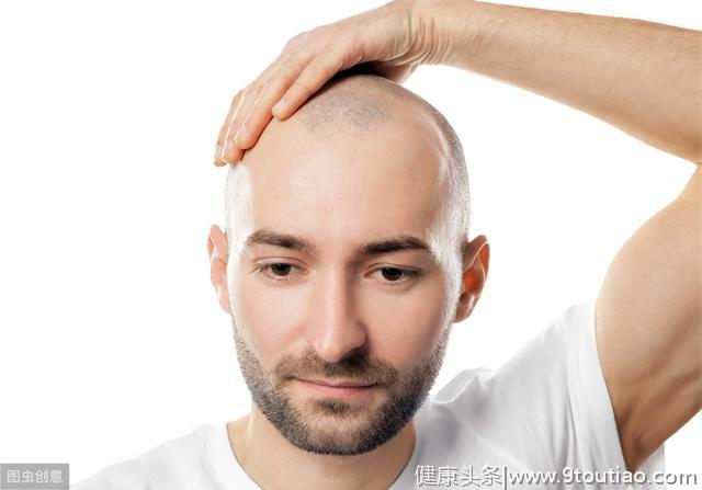 脱发也有遗传性？脂溢性脱发还有救吗？导致年轻人脱发的14个因素