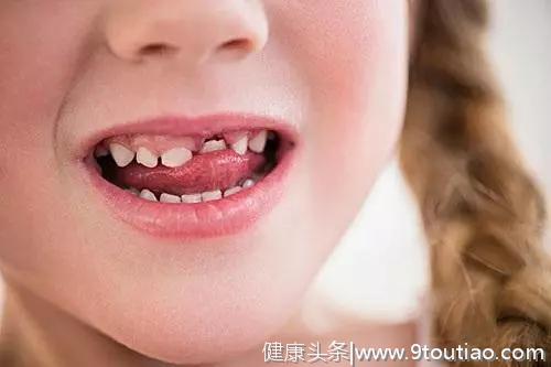 牙疼，孩子蛀牙太苦恼，做好这4步，从根源杜绝蛀牙风险
