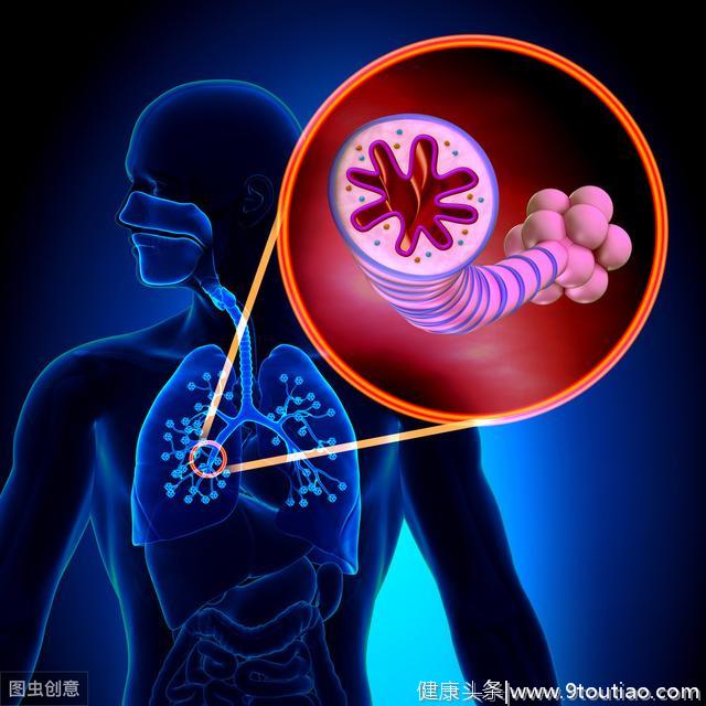 肺癌是最常见与死亡最多癌症之一，这些早期症状你知道吗