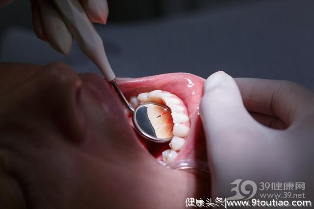 牙齿的6个症状表现，预示着身体出现这些问题！