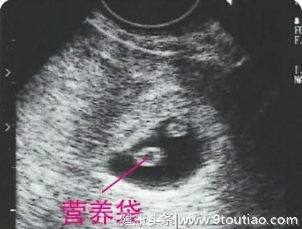 怀孕1-9个月，准妈妈通过B超看胎儿慢慢长大的样子，真是很神奇